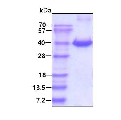 SDS-PAGE: Recombinant Human FKBP6 His Protein [NBP1-44384]